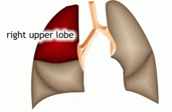 Lung Lobes 3D Function GIF