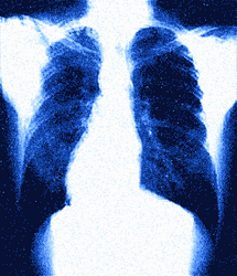 Lungs X-Ray Healthy Breathing GIF