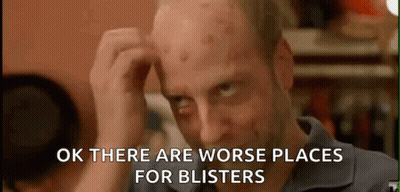 Man Acne Scratching Head Ok Worse Places Blisters GIF