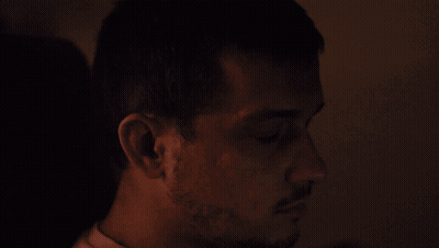 Man Bleeding From Face GIF