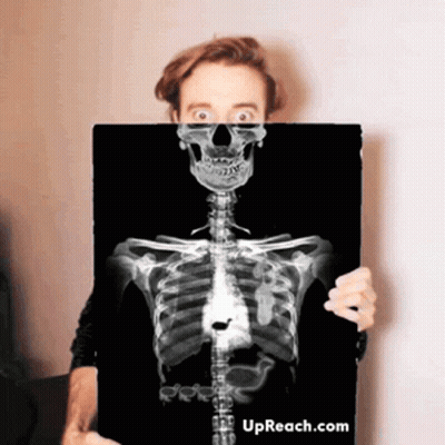 Man Holding X-Ray Skeleton With Upreach.com GIF