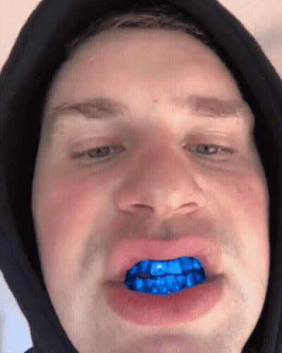 Man In Black Hoodie With Blue Teeth GIF