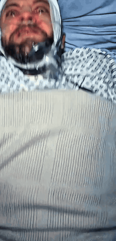 Man In Hospital Gown With Bandage On Head GIF