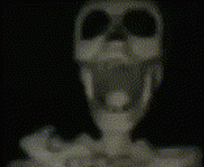 Man Standing On Stump In Woods GIF