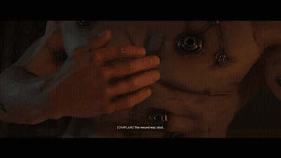 Man Talking To Chaplin Who Survived Rubicon Surgery GIF