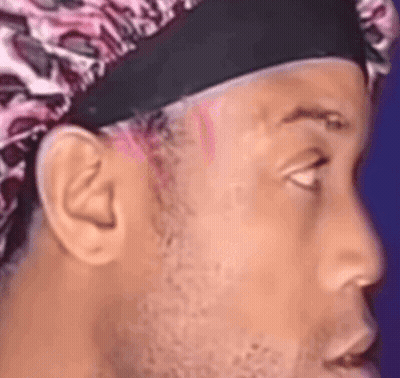 Man Wearing Headband And Surgical Cap GIF