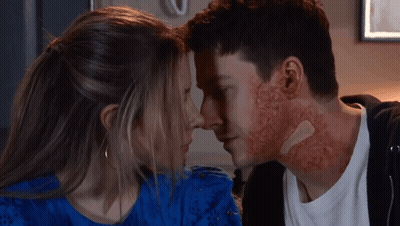 Man With Bandage Kissing Woman In Blue Dress GIF