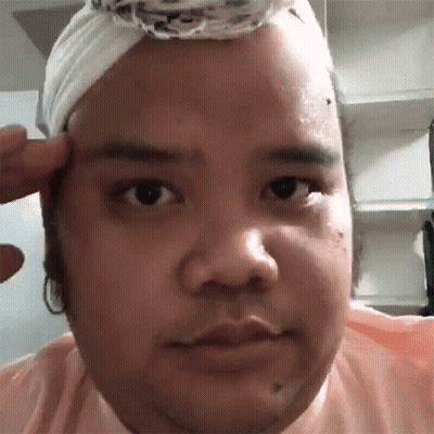 Man With Bandage On Head Looking At Camera GIF