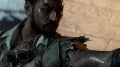 Man With Beard Holding Broken Arm GIF