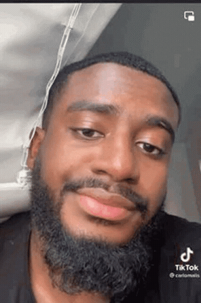 Man With Beard Making Funny Face GIF