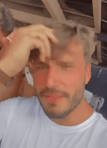 Man With Beard Scratching Head GIF