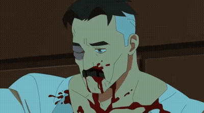 Man With Blood On Face I Miss My Wife GIF