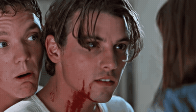Man With Blood On Neck Looks At Camera GIF