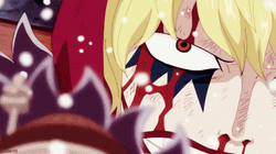 Man With Burn Scar Corazon One Piece GIF