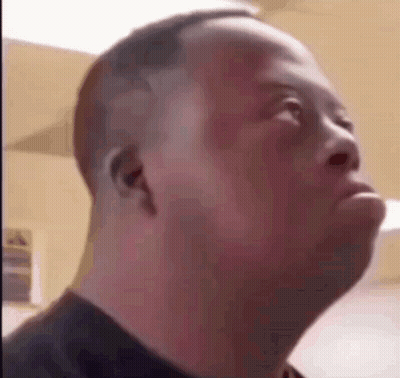 Man With Down Syndrome Making Funny Face GIF