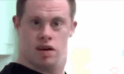 Man With Down Syndrome Making Funny Face GIF