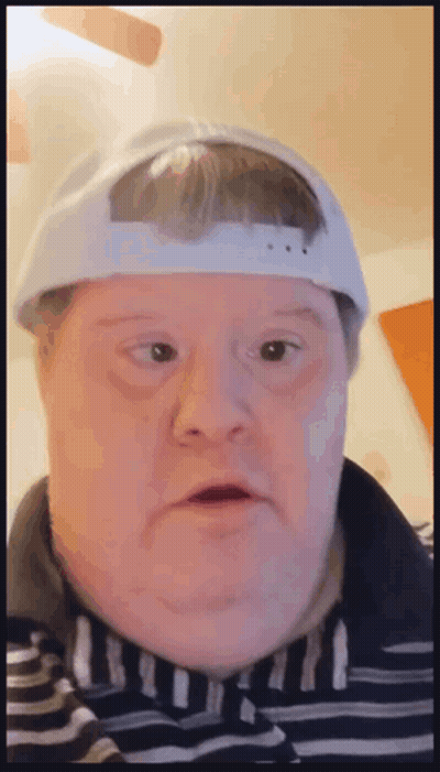 Man With Down Syndrome Wearing White Hat And Striped Shirt GIF