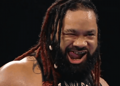 Man With Dreadlocks And Braces GIF