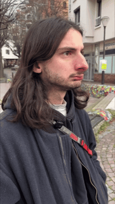 Man With Long Hair Red Nose Black Jacket GIF