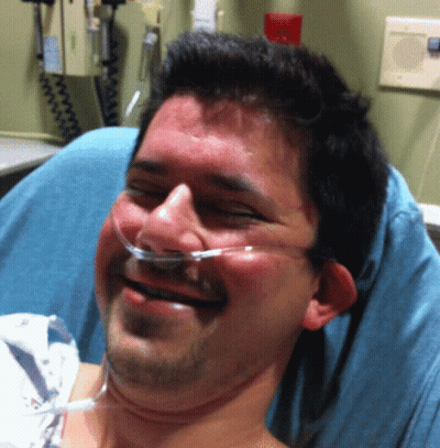 Man With Oxygen Tube Smiling In Hospital Bed GIF