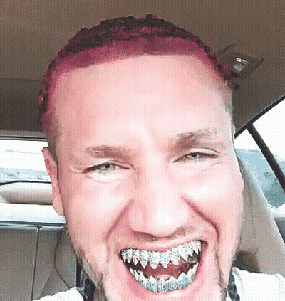Man With Pink Hair And Braces Smiling In Car GIF