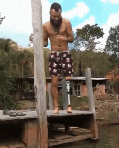 Man With Prosthetic Leg Overlooking Water GIF