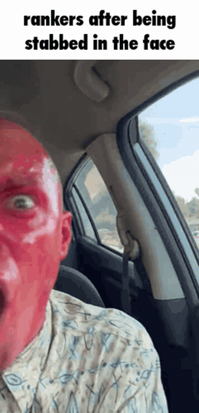 Man With Red Spots In Car Saying Rankers GIF