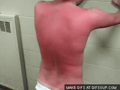 Man With Red Spots Standing GIF