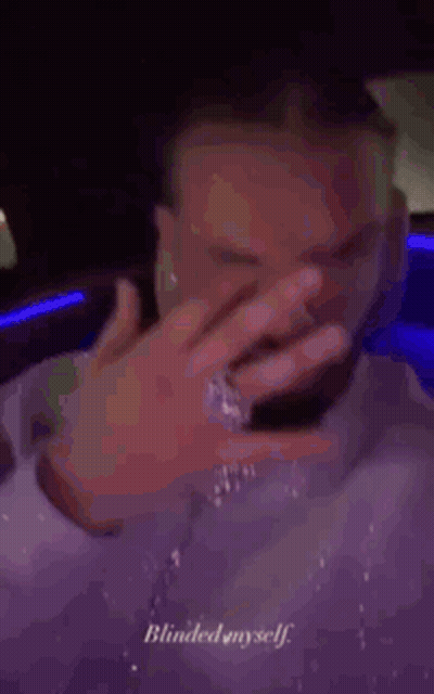 Man With Ring Blinding Himself GIF