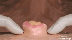 Massive Pimple Person Popping Out Clay Animation GIF
