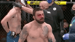 Mike Perry Face Injury GIF