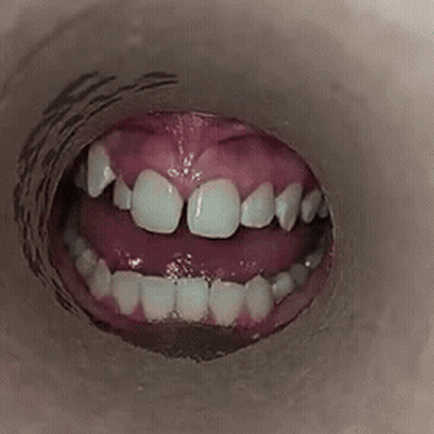 Mouth Showing Teeth GIF