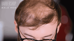 Northern Ireland Bald Man GIF
