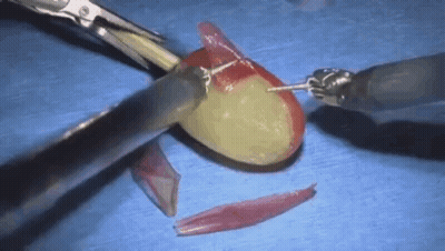 Person Cutting Grape With Scissors On Blue Table GIF