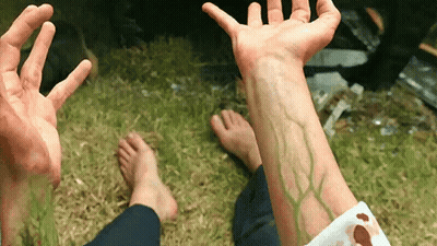 Person With Blood On Arm Reaching Up GIF