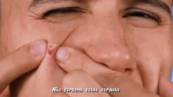 Pimple Popping Head Peeking Out Meme GIF