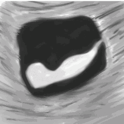 Pregnancy Baby Fetus Womb Art GIF