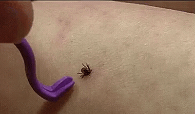 Purple Tick Removal Tool Removing Tick GIF