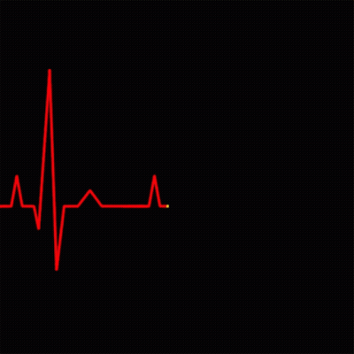 Red Heartbeat Line With Yellow Line GIF
