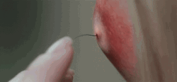 Scary Tiny Tentacle Pimple Popping GIF