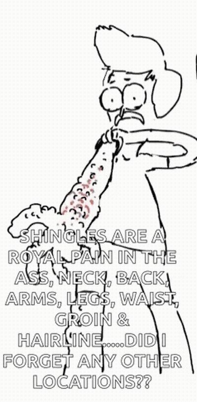 Shingles Royal Pain In The Ass GIF