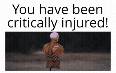 Skeleton Saying You Have Been Critically Injured GIF