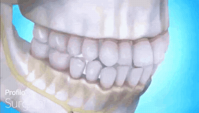 Skull With Braces Saying Surgical GIF