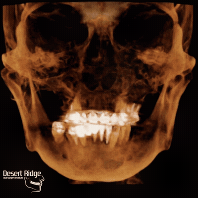 Skull X-Ray Desert Ridge Dental GIF