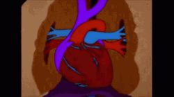 Stroke Heart Pump Clog Cartoon GIF