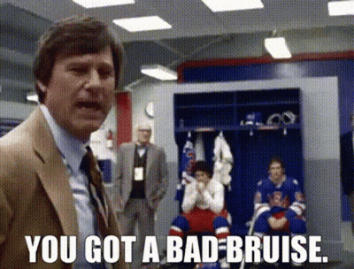 Suit Man Saying You Got Bad Bruise Hockey GIF