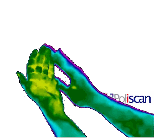 Thermal Image Of Hands With Liscan Sticker