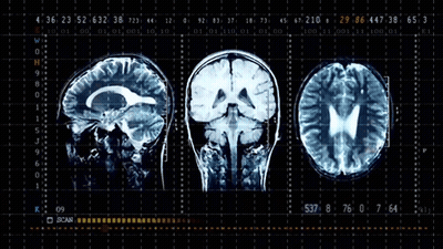Three Human Brains On Monitor GIF