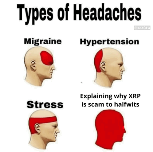 Types Of Headaches Including Migraine Hypertension And Stress GIF