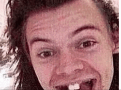 Ugly Harry Styles Predebut Pics GIF